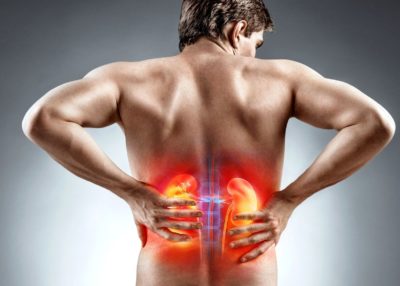 Боль в почках — что делать? | Клиника Радуга